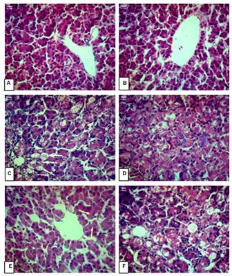 Curcumin Successfully Inhibited the Computationally Identified CYP2A6 Enzyme-Mediated Bioactivation of Aflatoxin B1 in Arbor Acres broiler